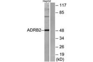 Western blot analysis of extracts from HepG2 cells, using ADRB2 Antibody. (beta 2 Adrenergic Receptor antibody  (AA 336-385))