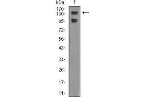 Western Blotting (WB) image for anti-Lysine (K)-Specific Demethylase 2B (KDM2B) (AA 457-555) antibody (ABIN5542614)