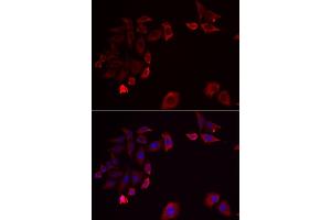 Immunofluorescence analysis of HeLa cells using SK antibody . (SKAP2 antibody  (AA 1-120))