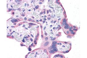 Immunohistochemistry (IHC) image for anti-Wilms Tumor 1 (WT1) (Middle Region) antibody (ABIN2780340) (WT1 antibody  (Middle Region))