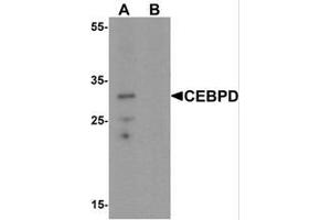 Western blot analysis of CEBPD in rat spleen tissue lysate with CEBPD Antibody  at 0.