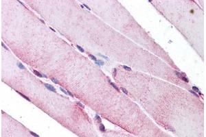 Human Skeletal Muscle: Formalin-Fixed, Paraffin-Embedded (FFPE) (SEPN1 antibody  (C-Term))