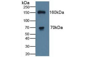 Figure. (ATP7B antibody  (AA 59-426))