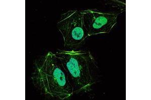 Immunofluorescence analysis of HL-60 cells using TNFRSF11B mouse mAb (green). (Osteoprotegerin antibody)