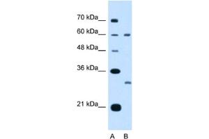 Western Blotting (WB) image for anti-Tetraspanin 32 (TSPAN32) antibody (ABIN2462993)