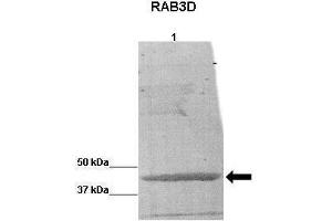 WB Suggested Anti-RAB3D Antibody    Positive Control:  Lane 1: BCAM0379 protein from B cenocepacia  Primary Antibody Dilution :   1:5000  Secondary Antibody :  Anti-rabbit-HRP   Secondry Antibody Dilution :   1:5000  Submitted by:  Katie Nurse (RAB3D antibody  (C-Term))