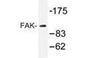 Western blot analysis of FAK antibody in extracts from 293 cells. (FAK antibody)