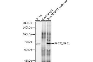 Immunoprecipitation analysis of 300 μg extracts of HeLa cells using 3 μg RP/RP antibody (ABIN7269915). (RPA1 antibody)