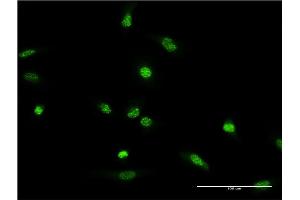Immunofluorescence of monoclonal antibody to XRCC2 on HeLa cell. (XRCC2 antibody  (AA 1-280))