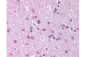 Anti-CLDN11 / Claudin 11 antibody IHC of human brain, cortex, white matter. (Claudin 11 antibody  (C-Term))