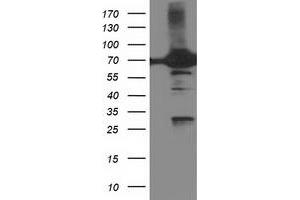 HEK293T cells were transfected with the pCMV6-ENTRY control (Left lane) or pCMV6-ENTRY DPP3 (Right lane) cDNA for 48 hrs and lysed. (DPP3 antibody)