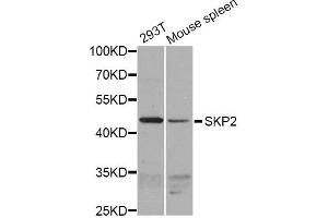Western blot analysis of extracts of various cell lines, using SKP2 antibody (ABIN1874793) at 1:1000 dilution. (SKP2 antibody)