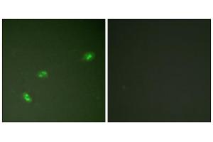 Immunofluorescence analysis of HeLa cells, treated with EGF (200nM, 5mins), using NPM (Phospho-Thr199) antibody. (NPM1 antibody  (pThr199))