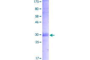 TNFRSF21 Protein (AA 47-214) (His-DYKDDDDK-Strep II Tag)