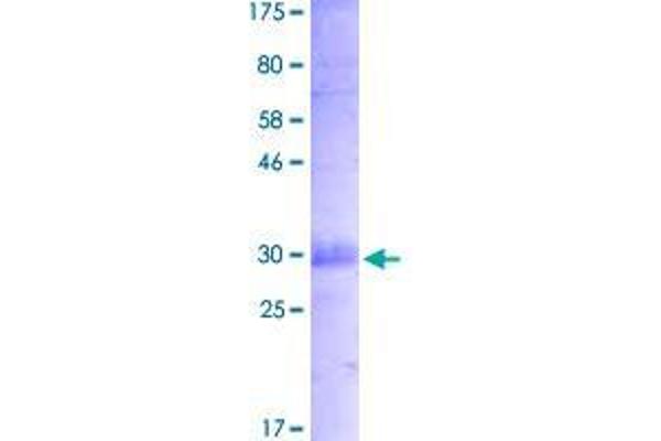 TNFRSF21 Protein (AA 47-214) (His-DYKDDDDK-Strep II Tag)