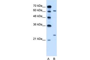 Western Blotting (WB) image for anti-RAR-Related Orphan Receptor A (RORA) antibody (ABIN2462863) (RORA antibody)
