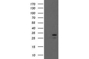 HEK293T cells were transfected with the pCMV6-ENTRY control (Left lane) or pCMV6-ENTRY EIF4E (Right lane) cDNA for 48 hrs and lysed. (EIF4E antibody)