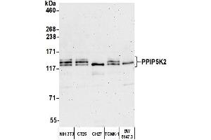 Western Blotting (WB) image for anti-diphosphoinositol Pentakisphosphate Kinase 2 (PPIP5K2) (AA 925-975) antibody (ABIN7450593)