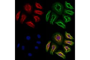 ABIN6262909 and ABIN6273260 staining Hela cells by IF/ICC. (LAPTM4B antibody  (Internal Region))