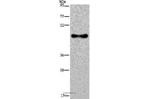 Western blot analysis of Human fetal brain tissue, using FADS1 Polyclonal Antibody at dilution of 1:300 (FADS1 antibody)