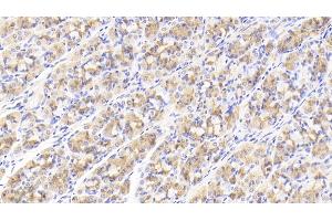 Detection of GDF5 in Human Stomach Tissue using Polyclonal Antibody to Growth Differentiation Factor 5 (GDF5) (GDF5 antibody  (AA 382-501))