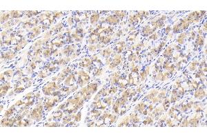 Detection of GDF5 in Human Stomach Tissue using Polyclonal Antibody to Growth Differentiation Factor 5 (GDF5)