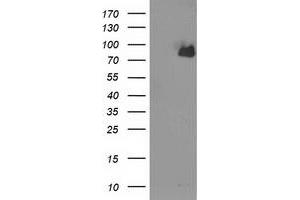 HEK293T cells were transfected with the pCMV6-ENTRY control (Left lane) or pCMV6-ENTRY ACSS2 (Right lane) cDNA for 48 hrs and lysed. (ACSS2 antibody)