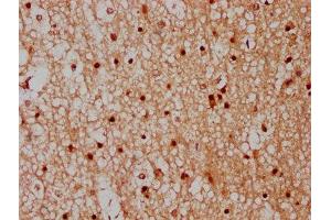 IHC image of ABIN7148527 diluted at 1:300 and staining in paraffin-embedded human brain tissue performed on a Leica BondTM system. (CPNE7 antibody  (AA 254-393))