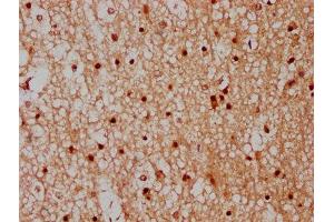 IHC image of ABIN7148527 diluted at 1:300 and staining in paraffin-embedded human brain tissue performed on a Leica BondTM system. (CPNE7 antibody  (AA 254-393))