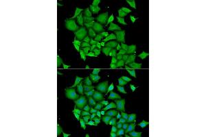 Immunofluorescence analysis of HeLa cells using DFFA antibody. (DFFA antibody)