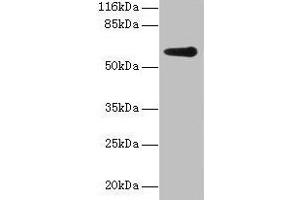 Western blot All lanes: GK2 antibody at 2 μg/mL + Jurkat whole cell lysate Secondary Goat polyclonal to rabbit IgG at 1/10000 dilution Predicted band size: 61 kDa Observed band size: 61 kDa (GK2 antibody  (AA 2-553))