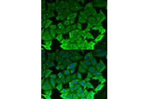 Immunofluorescence analysis of MCF-7 cells using EEF2K antibody. (EEF2K antibody)