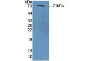 Western blot analysis of recombinant Mouse ZPI.