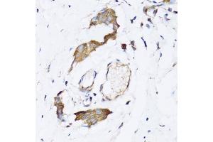 Immunohistochemistry (IHC) image for anti-ARD1 Homolog, N-Acetyltransferase (ARD1A) (AA 161-235) antibody (ABIN6144318)