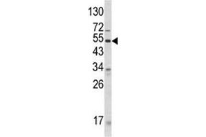 Western blot analysis of ANGPTL3 antibody and human CEM lysate. (ANGPTL3 antibody  (AA 82-114))