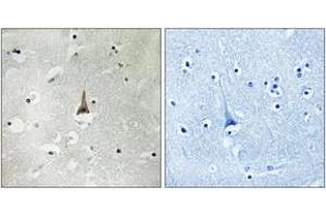 Immunohistochemistry analysis of paraffin-embedded human brain tissue, using LRP10 Antibody. (LRP10 antibody  (AA 204-253))
