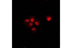 Immunofluorescent analysis of CIP4 staining in U2OS cells. (TRIP10 antibody)