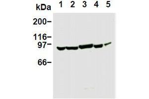 Western Blotting (WB) image for anti-Phosphoinositide 3 Kinase, p85 alpha (PI3K p85a) antibody (ABIN1108652) (PIK3R1 antibody)