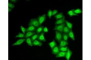 Immunofluorescence analysis of HeLa cells using SSRP1 Polyclonal Antibody (SSRP1 antibody)