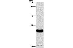 Western blot analysis of Human normal liver tissue, using BAAT Polyclonal Antibody at dilution of 1:600 (BAAT antibody)