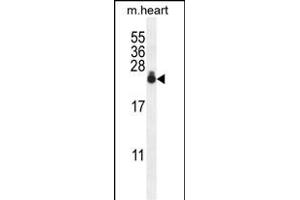 S3 Antibody (N-term) 0390a western blot analysis in mouse heart tissue lysates (35 μg/lane). (AP1S3 antibody  (N-Term))