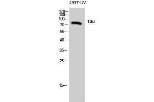 Western Blotting (WB) image for anti-tau Protein (Ser824) antibody (ABIN3177619) (tau antibody  (Ser824))