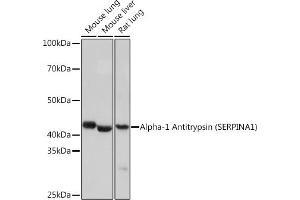 Western blot analysis of extracts of various cell lines, using Alpha-1 Antitrypsin (Alpha-1 Antitrypsin (SERPIN)) Rabbit mAb (ABIN7270239) at 1:1000 dilution.