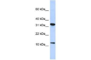 BTF3L1 antibody used at 0. (BTF3P11 antibody  (N-Term))