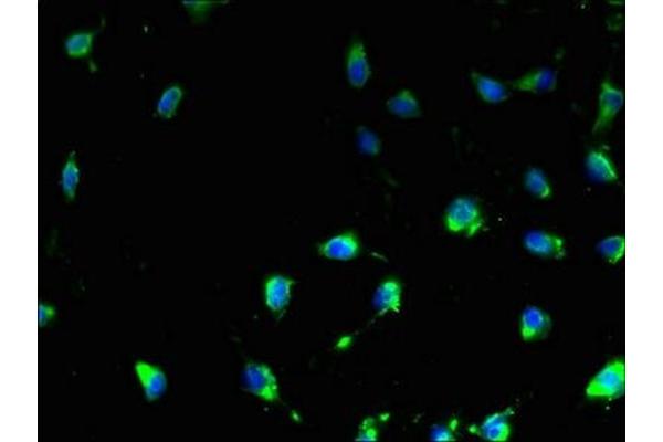 Transmembrane Protein 47 (TMEM47) (AA 42-82) antibody