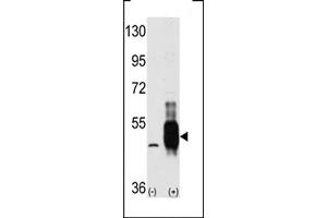 Western blot analysis of MEKK8 using MEKK8 Antibody using 293 cell lysates (2 ug/lane) either nontransfected (Lane 1) or transiently transfected with the MAP3K8 gene (Lane 2). (CROT antibody  (C-Term))