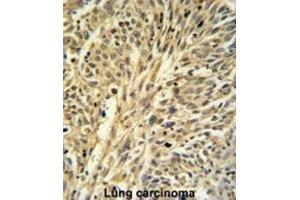 Immunohistochemistry (IHC) image for anti-IMP (Inosine 5'-Monophosphate) Dehydrogenase 2 (IMPDH2) antibody (ABIN3003184) (IMPDH2 antibody)