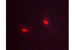 Immunofluorescence (fixed cells) (IF/ICC) image for anti-Tumor Protein P53 (TP53) (pSer392) antibody (ABIN6256312)