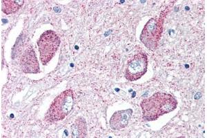 Human Brain, Basal Nucleus of Meynert (formalin-fixed, paraffin-embedded) stained with WNT8B antibody ABIN351424 at 10 ug/ml followed by biotinylated goat anti-rabbit IgG secondary antibody ABIN481713, alkaline phosphatase-streptavidin and chromogen. (WNT8B antibody  (Internal Region))
