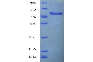 SDS-PAGE (SDS) image for Potassium Voltage-Gated Channel, Shaker-Related Subfamily, beta Member 2 (KCNAB2) (AA 1-367), (full length) protein (His-SUMO Tag) (ABIN5709787)